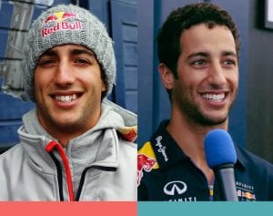 Braces Invisalign Before and After Daniel Ricciardo