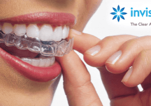 Invisalign Invisible Braces Wolverhampton